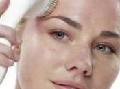 Fade Post Acne Marks, Dark Spots Pigmentation