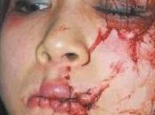 Saudi Arabia: Girl’s Lips Sewed Shut Calling Jesus Savior