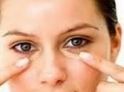 Home Remedies Dark Circles Under Eyes