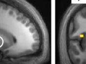 Habenula Does Tally Negative Outcomes.