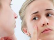 Some Acne Products Trigger Severe Allergic Reactions
