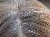 Home Remedies Preventing Premature Hair Grey