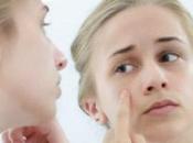 Super Effective Yogurt Face Masks Acne